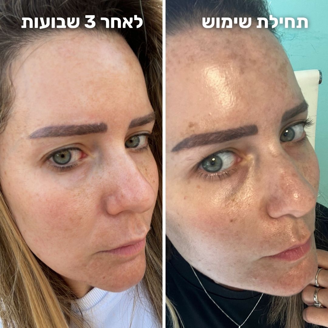 ⁦קרם לילה אקטיבי רטינול⁩ – תמונה ⁦5⁩